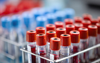 Blood test tubes in a rack.